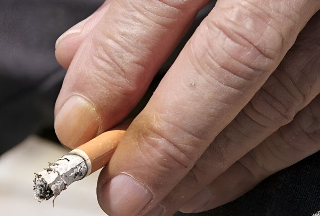 remove cigarette stains from fingers